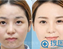整形广州,广州整形美容行业前沿动态与热门医院盘点